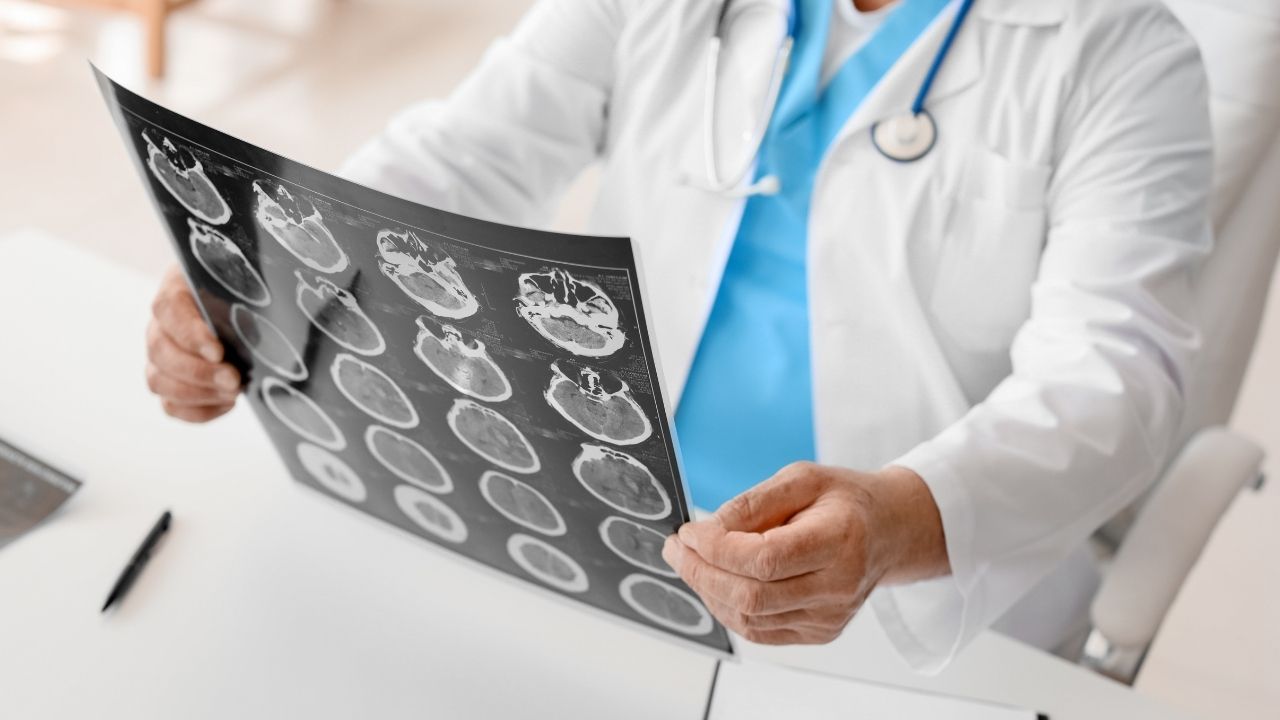 Hartford Traumatic Brain Injury Attorney